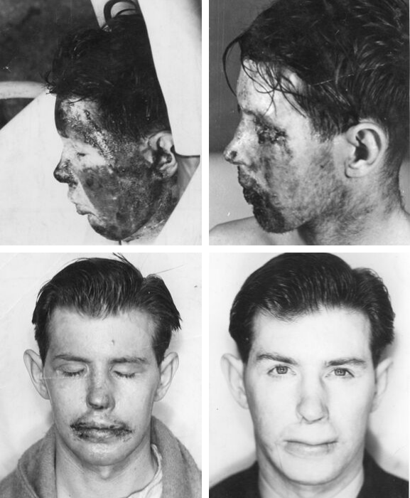 Vernon Mitchell Vernon Mitchell
